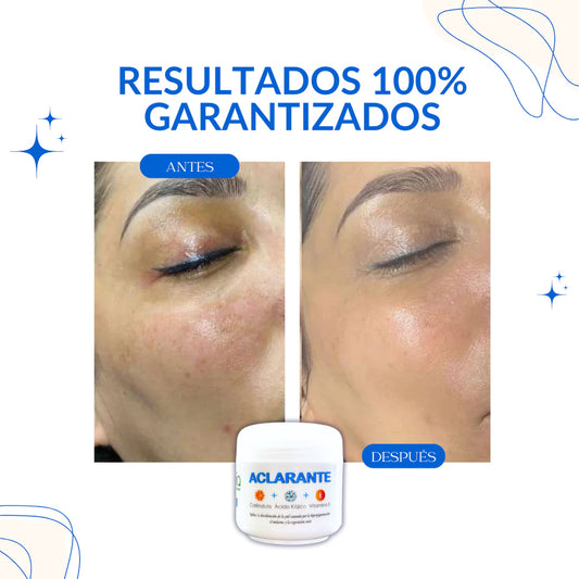 Nueva crema despigmentante: Obtén un rostro limpio, suave y radiante en 2 semanas